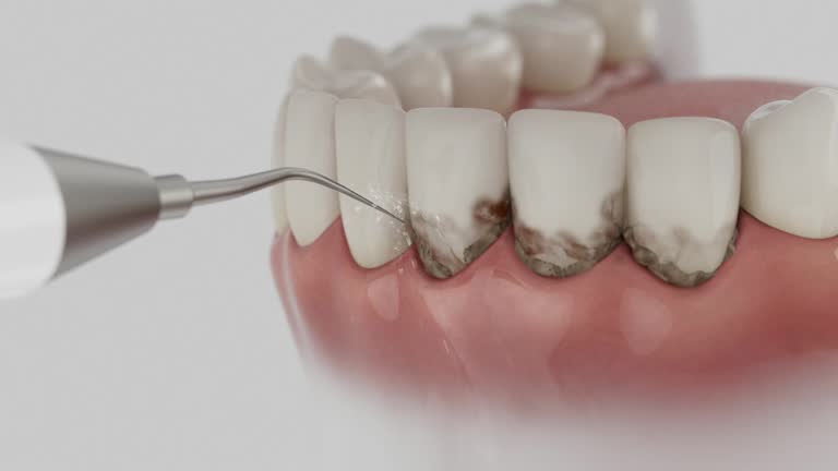 Trusted Dental Crowns And Bridges service in Lyons, GA - Dentist Open Now